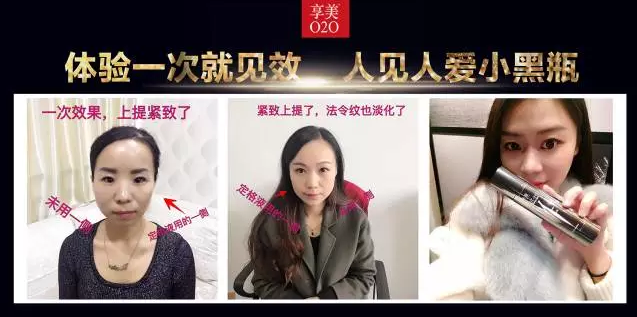 鄭州美博會_因V不凡，小黑瓶的魅力無法阻擋。